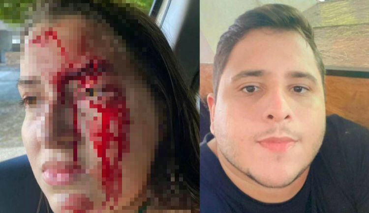 Filho de delegado suspeito de agredir a namorada é solto pela justiça
